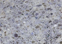 texture, marble, rock, limestone, granite wallpaper